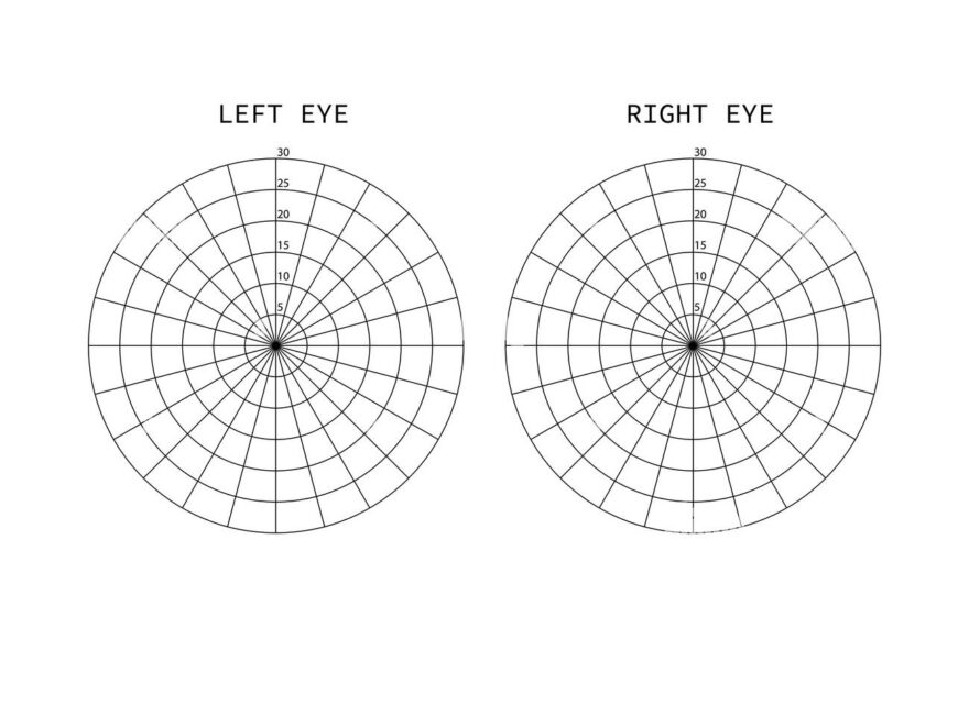 Amsler Test Grid Eye Scotoma Chart Oculist Vector Printable Chart Retina Examination Grid With Dot In Centre Vision Control Stock Vector Image Art Alamy