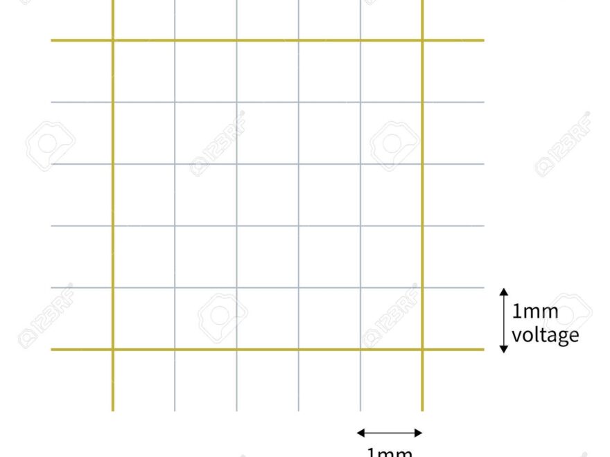 The ECG Paper Is Composed Of A Small Square With A Side Length Of 1mm The Abscissa Represents Time And The Ordinate Represents Amplitude Or Voltage Stock Photo Picture And Royalty Free