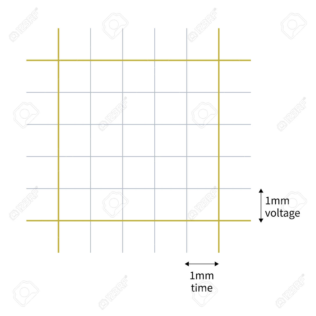 The ECG Paper Is Composed Of A Small Square With A Side Length Of 1mm The Abscissa Represents Time And The Ordinate Represents Amplitude Or Voltage Stock Photo Picture And Royalty Free The ECG Paper Is Composed Of A Small Square With A Side Length Of 1mm The Abscissa Represents Time And The Ordinate Represents Amplitude Or Voltage Stock Photo Picture And Royalty Free